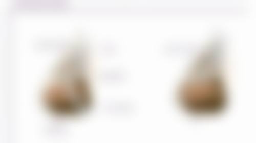 一、全切双眼皮手术是咋回事