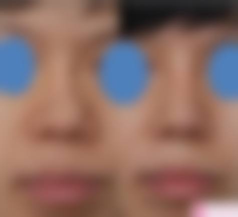 优惠活动详情:限时体验,开启美丽之旅