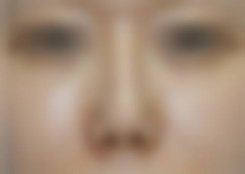 四、韩国Briller clinic皮肤科特色项目