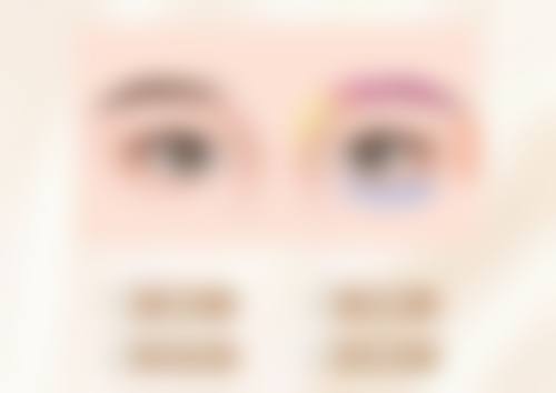 一、全切双眼皮手术修复的大致时间