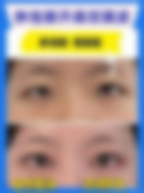八、广州爱莱美医疗美容门诊预约方式