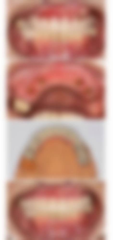 常见问题解答