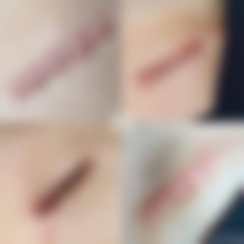 七、韩国Briller clinic皮肤科地址及交通