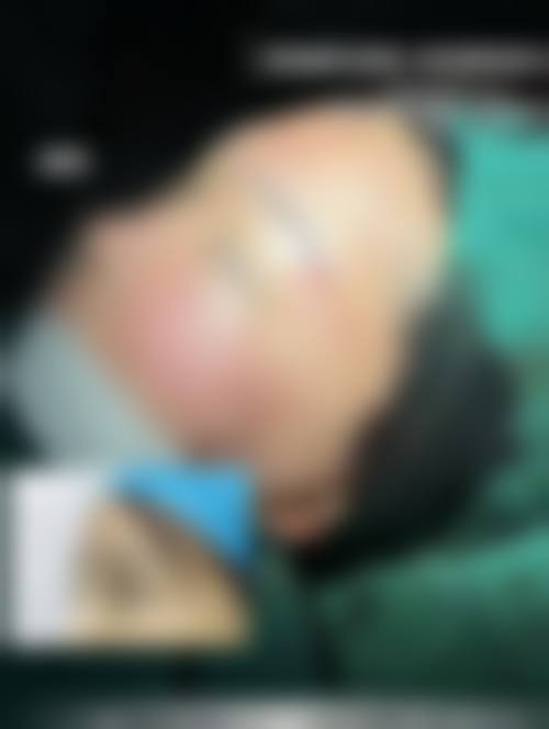 临床实例分享