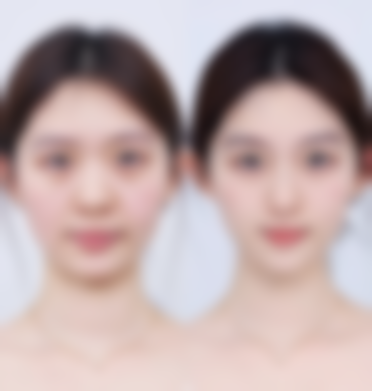 九、广州爱莱美医疗美容门诊真实的患者评价