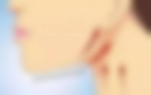三、50岁有必要做眼袋手术吗之吸脂去眼袋成效