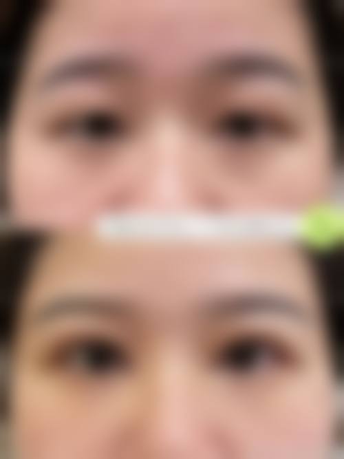 八、杭州艺美紫馨整形医院真实的患者评价