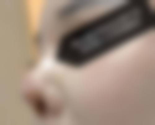 nano整形外科的技术优势有哪些？