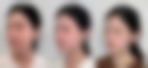 从真实反馈看张掖曲媄医疗美容诊所的口碑