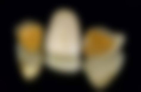 结尾:专精护航,即刻预约