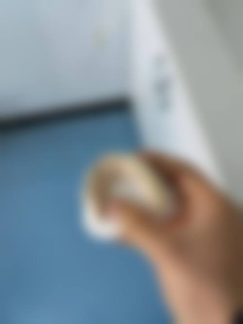 临床实例分享
