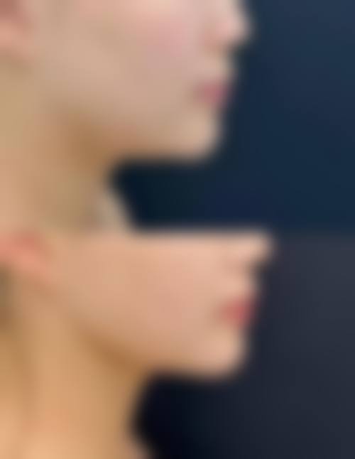 nano整形外科的医生团队怎么样？