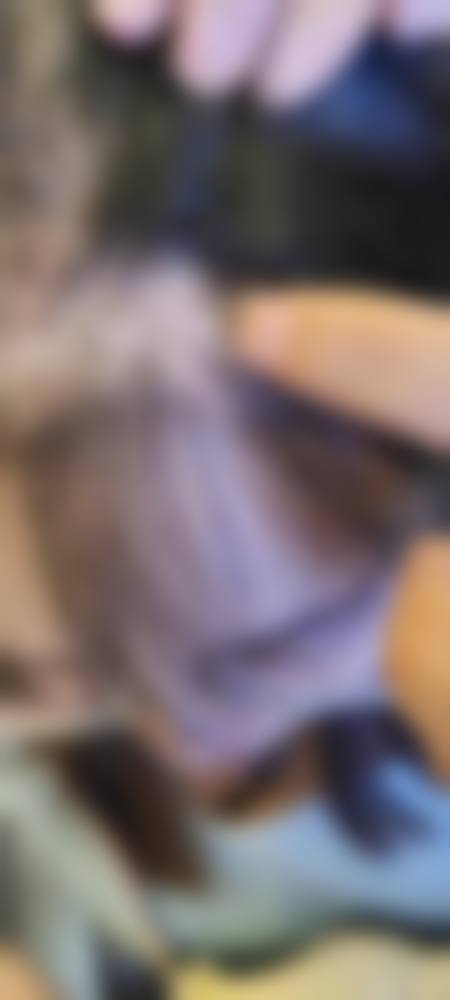 四、厦门大麦微针植发特色项目