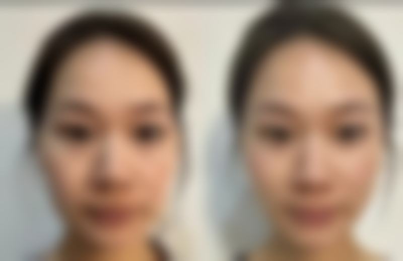 关于张掖曲媄医疗美容诊所，你关心的几个问题