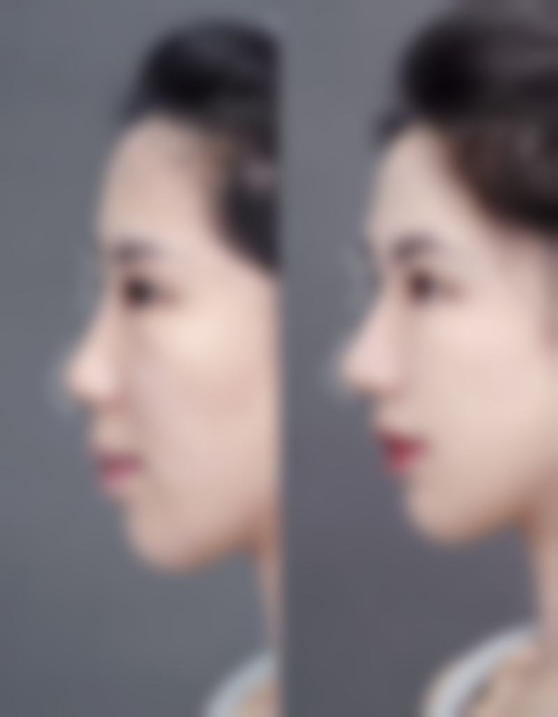 张掖曲媄医疗美容诊所正规吗？这是特别多人关心的问题