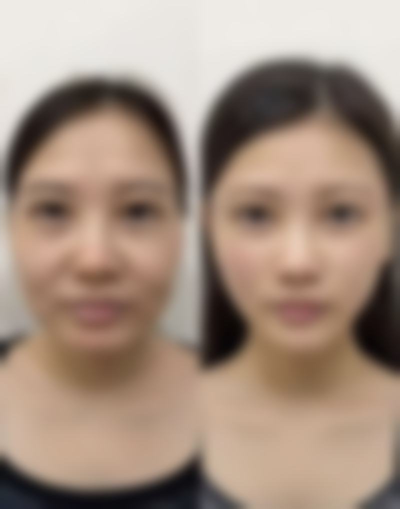 nano整形外科擅长哪些项目？